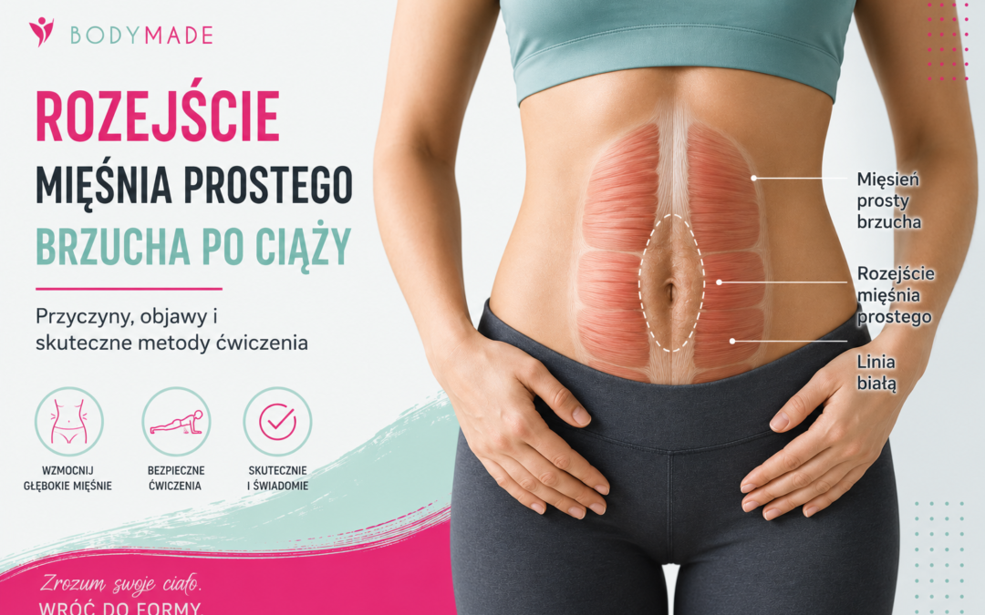 Rozejście mięśnia prostego brzucha po ciąży – jak ćwiczyć, czego unikać i czy można je zlikwidować nawet kilka lat po porodzie?